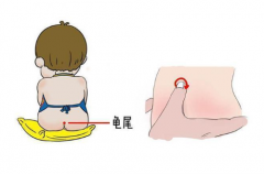 红色胎记是什么命