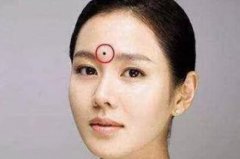 眉毛上有疤痕命运如何，眉毛有疤代表了什么